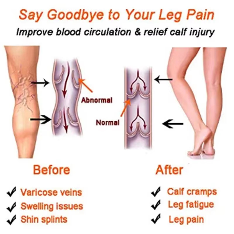 Women Compression Socks Slimmi - Compression Calf Sleeve recensie en prijs
